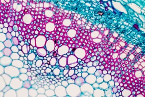 Plant cross section, microscope slide dyed for contrast. Image: Sinhyu/Getty Images.